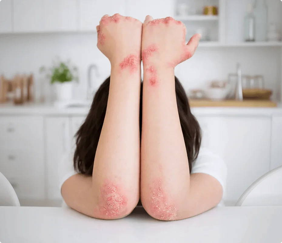 Rash image